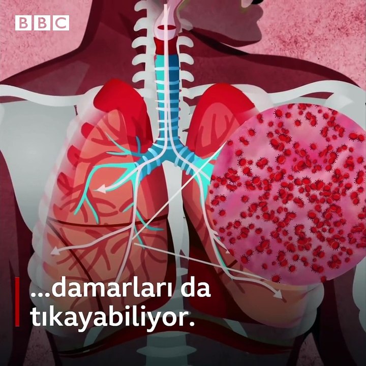 Koronavirüs vücudumuzu nasıl etkiliyor