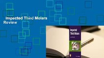 Impacted Third Molars  Review