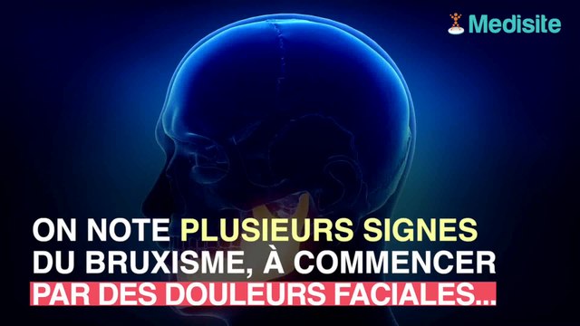 Grincer des dents : ce que vous risquez