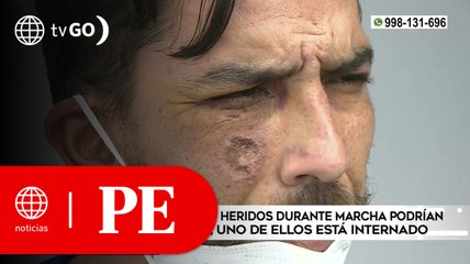 Jóvenes heridos durante marcha podrían perder la visión | Primera Edición