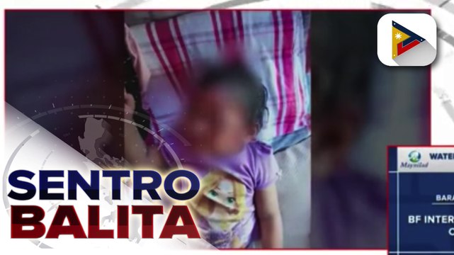 MALASAKIT AT WORK: Bata sa Rodriguez, Rizal, nalapnos ang mukha at nawalan pa ng bahay nang manalasa ang bagyong #UlyssesPH Kung kayo'y mayroong kakilala na nais matulungan, maari kayong mag-comment sa aming Facebook page na PTV MALASAKIT AT WORK. Maar