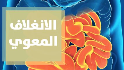 ما هو الانغلاف المعوي؟ وأعراضه؟