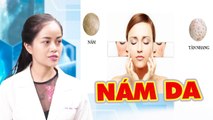 Bác sĩ nói gì #51 | Tìm hiểu về bệnh NÁM DA, nguyên nhân và phòng tránh NÁM DA