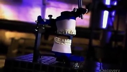 How Its Made - 711 Dental Crowns