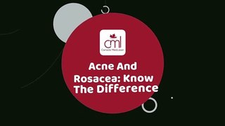 Acne Vs. Rosacea: Know The Difference | Canada MedLaser