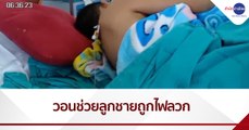 แม่วอนช่วยลูกชาย 8 ขวบ ถูกไฟลวกเจ็บสาหัส