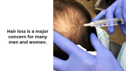 PRECISION PRP™ THERAPY - YAKER Hair Restoration + Med Spa.