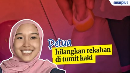 Tumit kaki merekah? Ini ubatnya