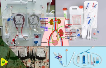 Hémodialyse au Sénégal : Révélations sur une mafia de détournement de fonds et de commercialisation