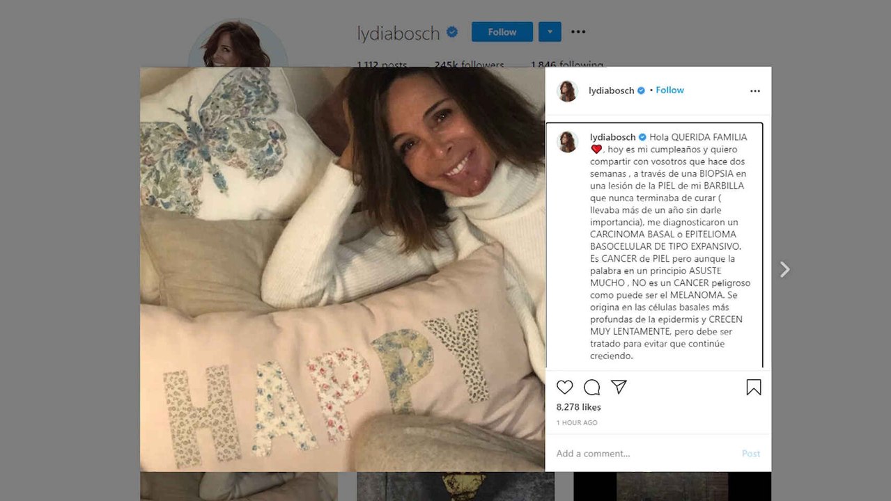 Lydia Bosch confiesa que tiene cáncer de piel