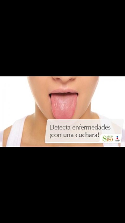 Detecta enfermedades ¡con una cuchara! | Cortos por Salud180