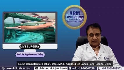 Arm Liposuction Before & After Done by Cosmetic / Plastic Surgeon Dr. PK Talwar