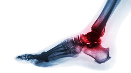 Major Twist: Why Biden Will Be Seen By An Orthopedist