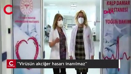''Virüsün akciğer hasarı inanılmaz''