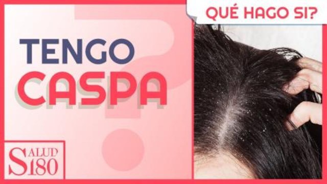 Remedio natural y efectivo para eliminar la caspa | Salud 180