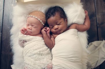 Ces jumeaux uniques ont bien grandi et vont faire fondre votre coeur