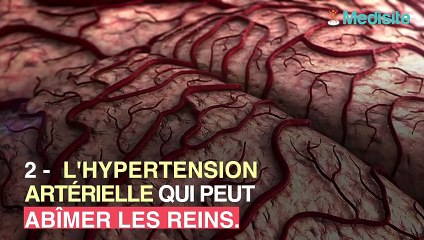 Les signes que vos reins sont malades