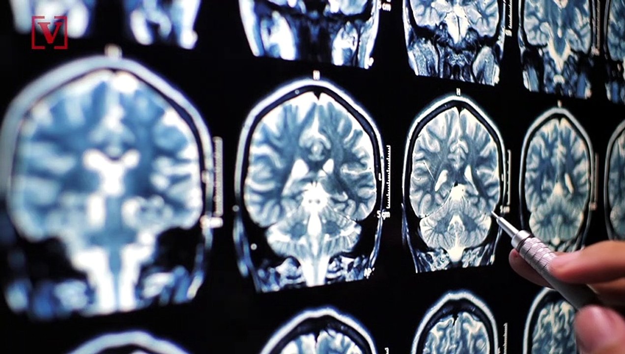 A Blood Test Could Be the New Way to Test for A...