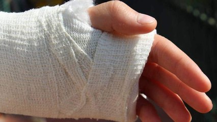Diciembre apenas inicia y ya se reportan personas quemadas en Colombia