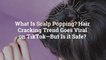 What Is Scalp Popping? Hair Cracking Trend Goes Viral on TikTok—But Is it Safe?
