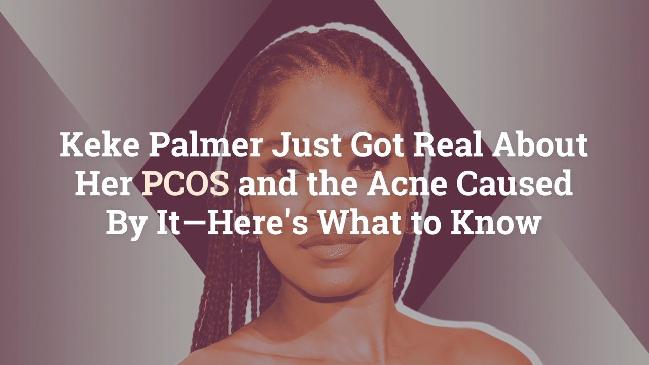 Keke Palmer Just Got Real About Her PCOS and the Acne Caused By It—Here’s What to Know