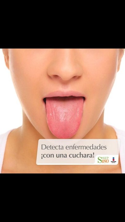 Detecta enfermedades ¡con una cuchara!