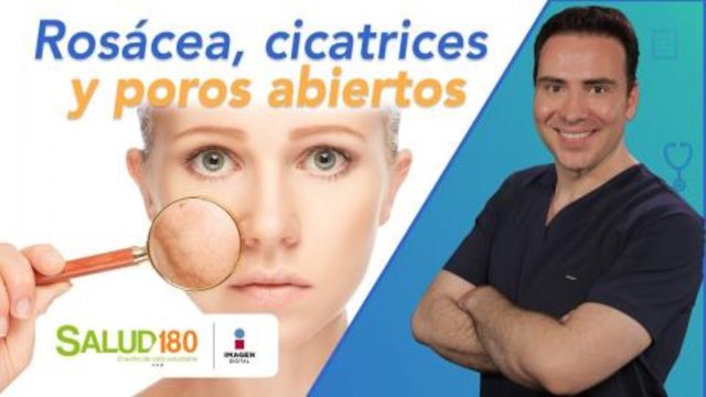 Dr. Salud | Rosácea, cicatrices y poros abiertos | Salud180