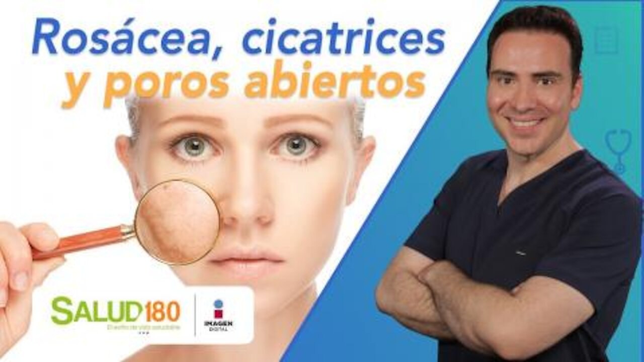 Dr. Salud | Rosácea, cicatrices y poros abiertos | Salud180