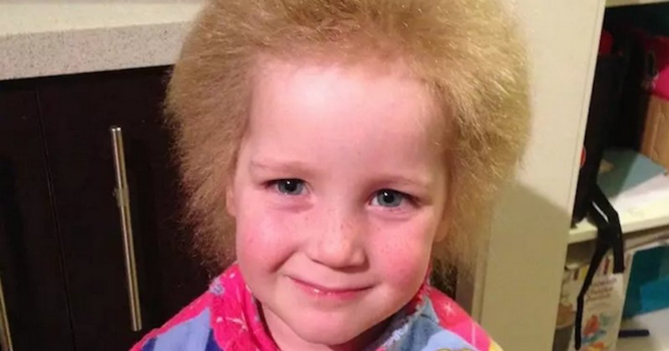 La chevelure de cette fillette est incoiffable, ce qui lui a valu d'être comparée à Albert Einstein