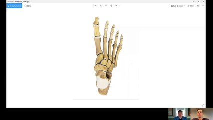 Joe Biden foot fracture - evaluation, treatment and implications for work of cuneiform fractures.