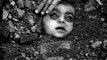 Heartbreaking Story Of The People Affected Bhopal Gas Tragedy Even After 20 Years To The Incident
