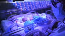 Expertos proyectan crear placenta artificial para bebés prematuros