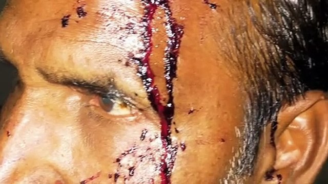 ग्राम बाजूनगर में दो पक्षों में हुई जमकर मारपीट, एक पक्ष के कई लोग हुए घायल
