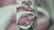 Videoja emocionuese: Momentet e para të lindjes së trinjakëve në maternitetin “Koço Gliozheni”