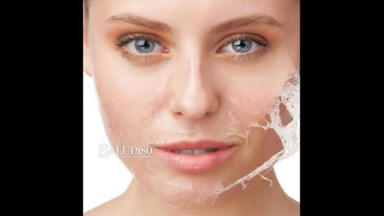 Mascarilla contra las imperfecciones del rostro