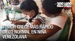 Tumor crece más rápido de lo normal en niña Venezolana - Rostros de la Crisis - Vpitv