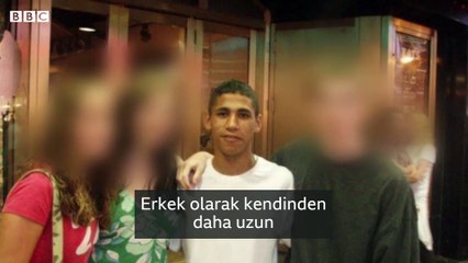 Boy uzatma ameliyatları