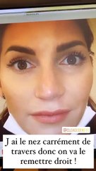 Nadège Lacroix se fait oprérer du nez