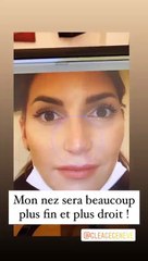 Nagède Lacroix dévoile pourquoi elle se fait encore opérer du nez, story Instagram, le 7 décembre 2020