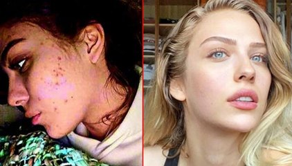 Yasemin Şefkatli takipçilerini uyardı: Bilmediğiniz ürünleri kullanmayın