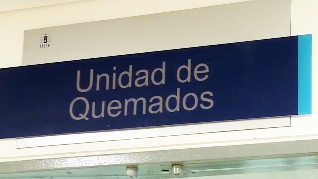 Lesionados con pólvora siguen llegando a los pabellones de quemados en todo el país
