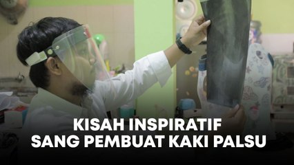 Cerita Inspiratif Fitriandaka Kurnia, Sang Pembuat Kaki Palsu