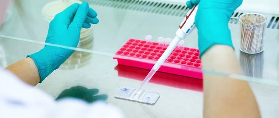 Siècle Vert - La recherche en agriculture : un défi majeur pour l'alimentation mondiale