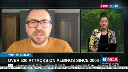 Over 520 attacks on albinos since 2006
