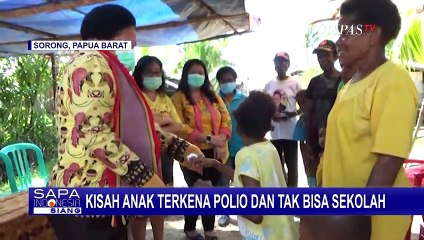 Didiagnosis Polio Sejak Umur Satu Tahun, Seorang Anak di Sorong Belum Pernah Sekolah Formal