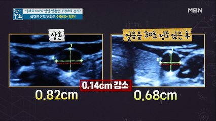 갑작스런 혈관 수축이 우리 몸에 미치는 영향