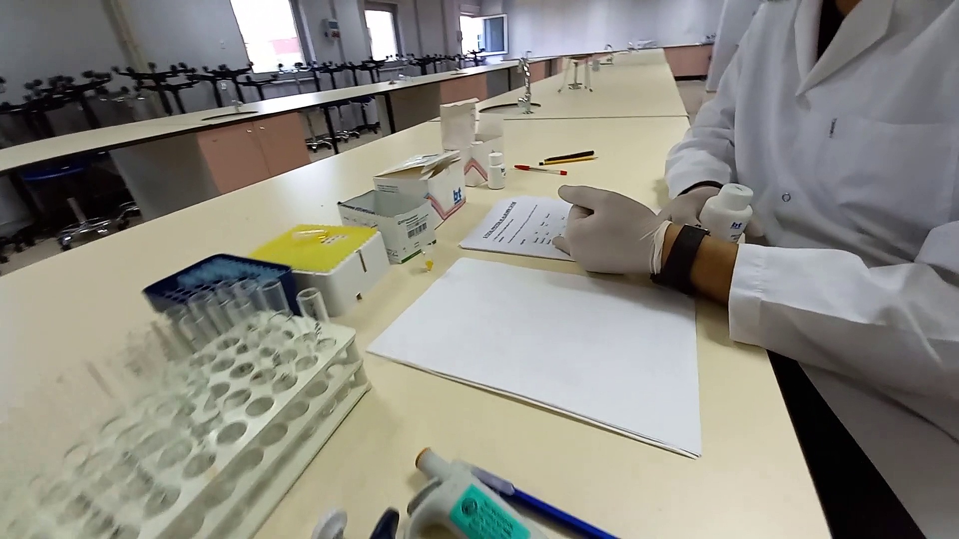 Total Protein-Albümin Deneyi