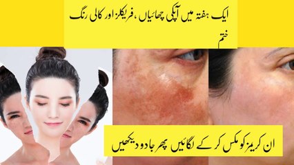 Skin whitening formula | Remove pigmentation  | Freckles | Skin white in one week Challenge