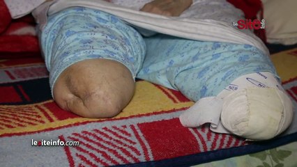 عجوز مبثورة القدمين وفاقدة للبصر تطلب المساعدة_ الراجل مات وماعنديش الأولاد وأنا بوحدي كنخاف