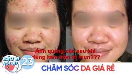 Bác Sĩ Nói Gì | Tập 23: Lợi bất cập hại từ việc chăm sóc da giá rẻ tràn lan trên thị trường